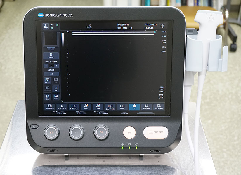 超音波治療器を導入しており患者それぞれに対してリハビリ時でも使用できるように準備しております。