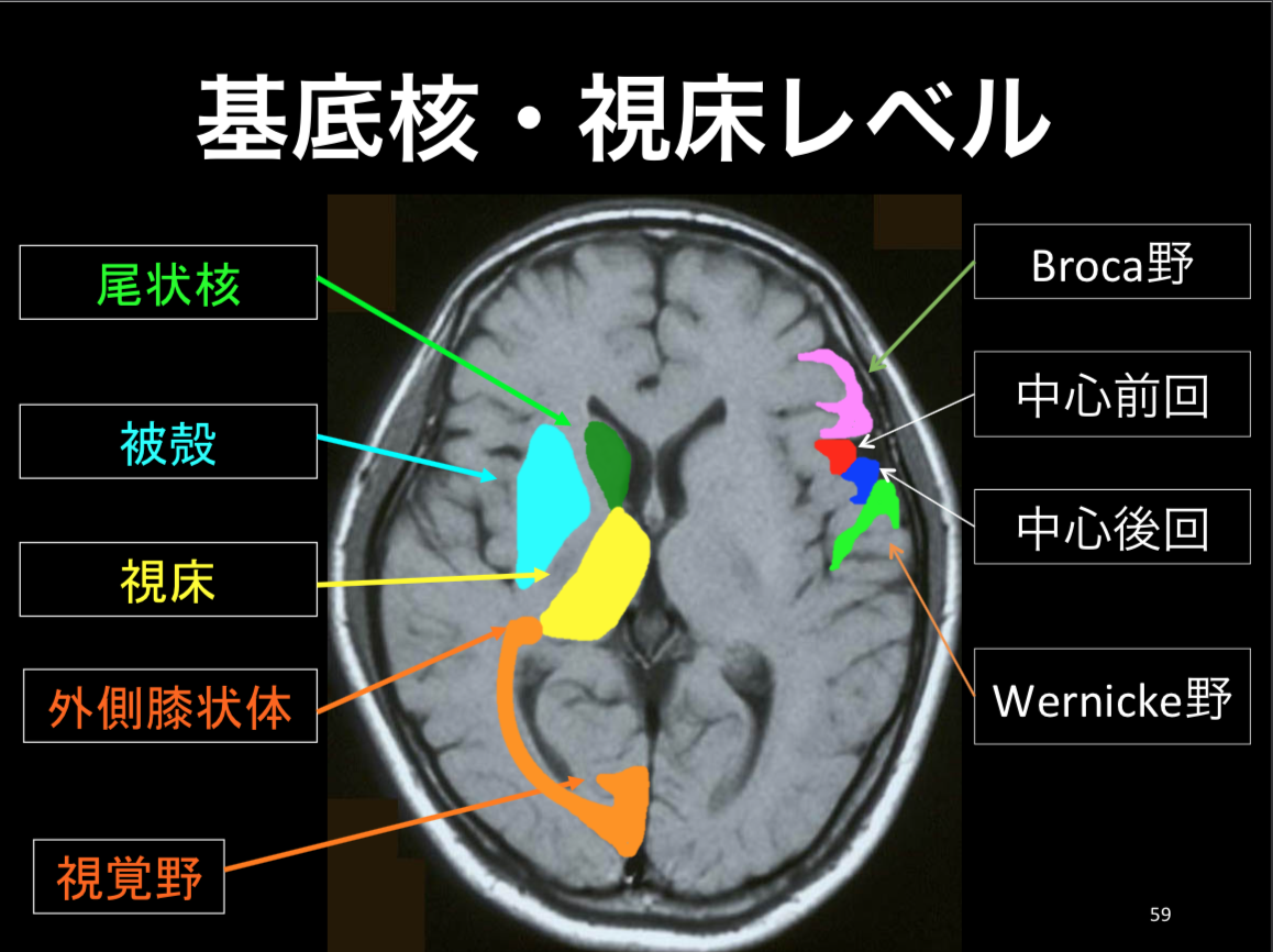 脳 mri 部位: 脳 mri 画像 – QZIOS
