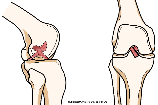 解剖学 運動学から考える膝関節の評価と治療 14日間の見逃し配信付き Pt Ot St Net