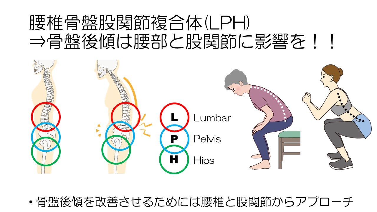 不良姿勢(円背・猫背・骨盤後傾)に対するアプローチ|PT-OT-ST.NET