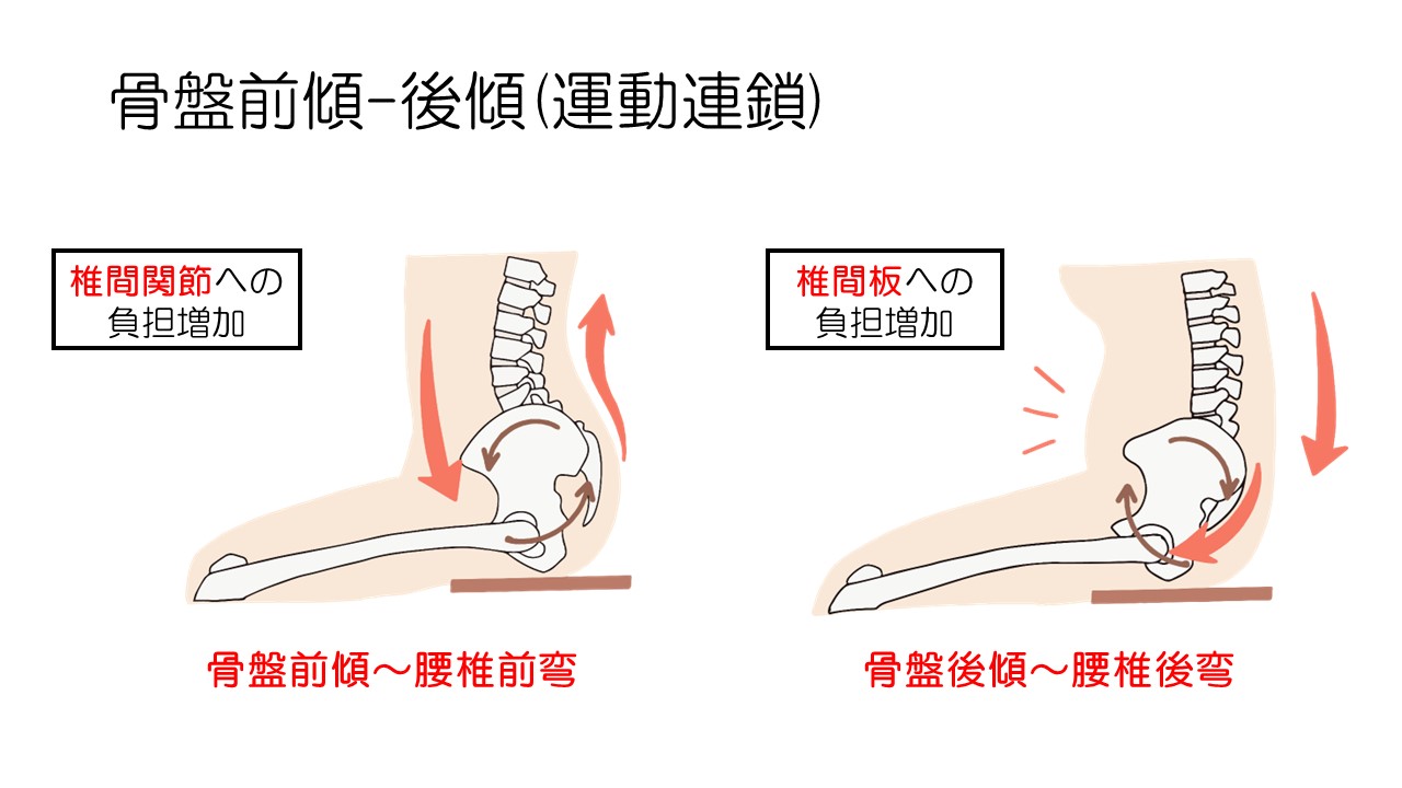 不良姿勢(円背・猫背・骨盤後傾)に対するアプローチ|PT-OT-ST.NET