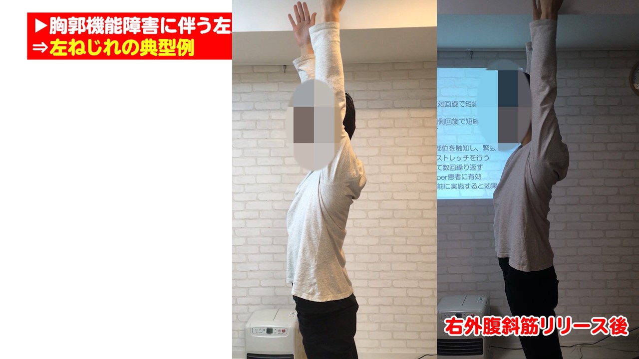 脱・対症療法 胸郭・体幹2ステップ調整法 DVD 整体 Amazon.co.jp: 関節ニュートラル整体・自己調整法: 新PNF整体