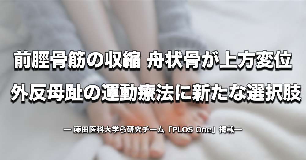前脛骨筋の収縮が内側縦アーチを挙上・母趾を内反、外反母趾への運動療法に新たな根拠｜藤田医科大学らPLOS Oneに報告